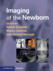 Imaging of the Newborn - eBook