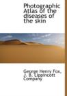 Photographic Atlas of the Diseases of the Skin - Book