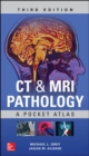 CT & MRI Pathology: A Pocket Atlas, Third Edition - Book
