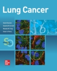 Lung Cancer:  Standards of Care - Book
