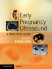 Early Pregnancy Ultrasound : A Practical Guide - Book