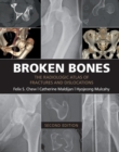 Broken Bones : The Radiologic Atlas of Fractures and Dislocations - eBook