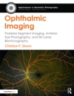 Ophthalmic Imaging : Posterior Segment Imaging, Anterior Eye Photography, and Slit Lamp Biomicrography - eBook