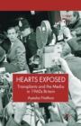 Hearts Exposed : Transplants and the Media in 1960s Britain - Book