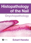 Histopathology of the Nail : Onychopathology - eBook