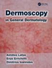 Dermoscopy in General Dermatology - eBook