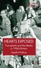 Hearts Exposed : Transplants and the Media in 1960s Britain - Book