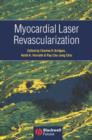 Myocardial Laser Revascularization - Book