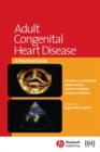 Adult Congenital Heart Disease : A Practical Guide - eBook