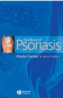 Handbook of Psoriasis - Charles Camisa