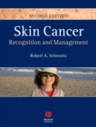Skin Cancer : Recognition and Management - Book