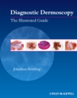 Diagnostic Dermoscopy : The Illustrated Guide - Book