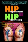 Hip Replacement or Hip Resurfacing: A Story of Choices - Book