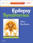 Epilepsy Syndromes - Book