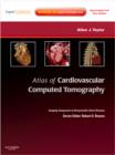 Atlas of Cardiovascular Computed Tomography : Imaging Companion to Braunwald's Heart Disease - Book