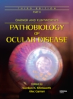 Garner and Klintworth's Pathobiology of Ocular Disease (Part B) - eBook