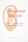 Cesarean Section : An American History of Risk, Technology, and Consequence - Book
