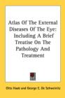 ATLAS OF THE EXTERNAL DISEASES OF THE EY - Book