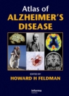 Atlas of Alzheimer's Disease - eBook