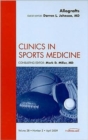 Allografts, An Issue of Clinics in Sports Medicine : Volume 28-2 - Book