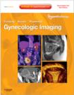 Gynecologic Imaging : Expert Radiology Series (Expert Consult Premium Edition - Enhanced Online Features and Print) - Book