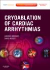 Cryoablation of Cardiac Arrhythmias - Book