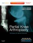 Partial Knee Arthroplasty : Techniques for Optimal Outcomes - Book
