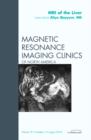 MRI of the Liver, An Issue of Magnetic Resonance Imaging Clinics : Volume 18-3 - Book