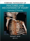 Forensic Pathology of Fractures and Mechanisms of Injury : Postmortem CT Scanning - Book