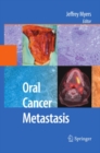 Oral Cancer Metastasis - eBook