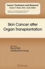 Skin Cancer after Organ Transplantation - Book