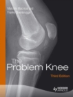 The Problem Knee - Book