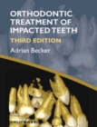 Orthodontic Treatment of Impacted Teeth - eBook