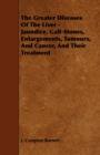 The Greater Diseases Of The Liver - Jaundice, Gall-Stones, Enlargements, Tumours, And Cancer, And Their Treatment - Book