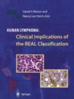 Human Lymphoma: Clinical Implications of the REAL Classification - Book