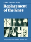Replacement of the Knee - eBook