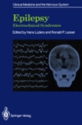 Epilepsy : Electroclinical Syndromes - eBook