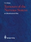 Tumours of the Nervous System : an Ultrastructural Atlas - eBook