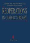 Reoperations in Cardiac Surgery - Book