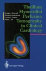 Thallium Myocardial Perfusion Tomography in Clinical Cardiology - eBook