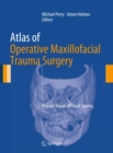 Atlas of Operative Maxillofacial Trauma Surgery : Primary Repair of Facial Injuries - eBook