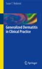 Generalized Dermatitis in Clinical Practice - Book