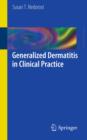 Generalized Dermatitis in Clinical Practice - eBook