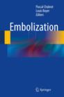 Embolization - eBook