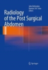 Radiology of the Post Surgical Abdomen - Book