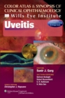 Color Atlas and Synopsis of Clinical Ophthalmology - Wills Eye Institute - Uveitis - Book