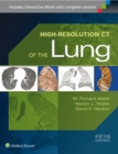 High-Resolution CT of the Lung - Book