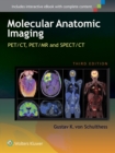 Molecular Anatomic Imaging : PET/CT, PET/MR and SPECT CT - Book