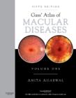 Gass' Atlas of Macular Diseases E-Book : 2-Volume Set - Expert Consult: Online and Print - eBook
