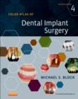 Color Atlas of Dental Implant Surgery - Book